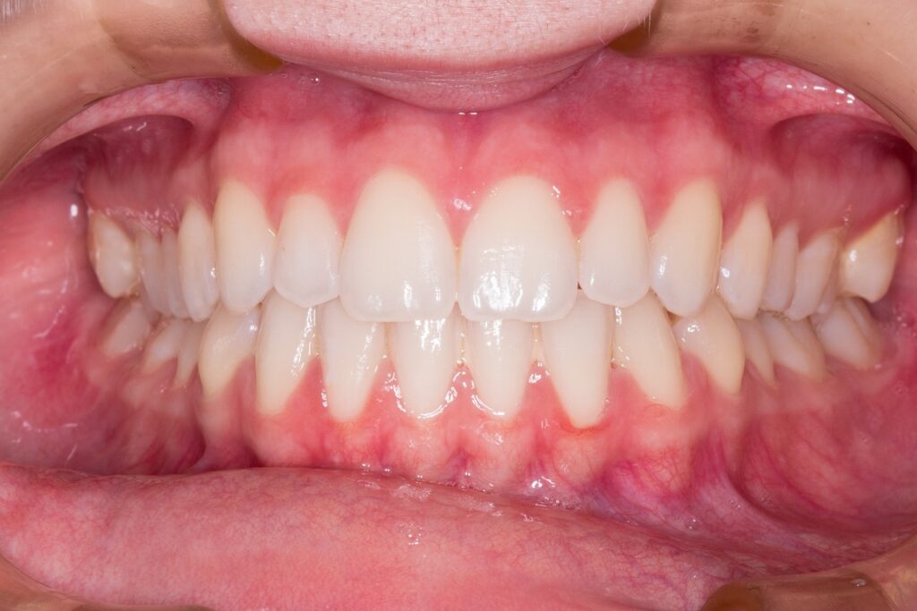 find trusted dentists near you offering comprehensive dental care, including cleanings, check-ups, cosmetic dentistry, and emergency services for a healthy, beautiful smile.